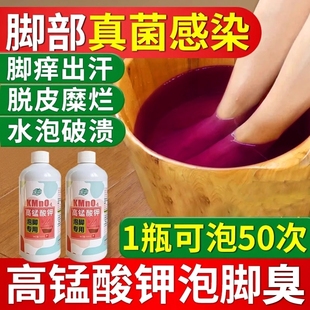 高锰酸钾泡脚溶液除臭粉脱皮杀菌除痒水泡烂脚丫片水真菌克星
