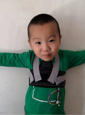 婴幼儿童肋骨外翻固定带心脏术后胸部压力绑带鸡胸凸出矫正器护胸