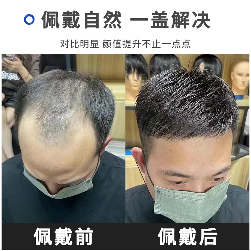 假发男短发毛寸全真发无痕隐形假发片男士可粘可卡轻薄头顶补发片