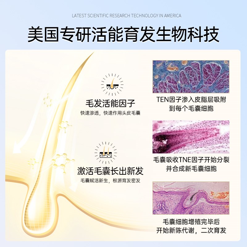 OHBT蔓浓防脱育发液头皮护理生发增发营养液配方图片