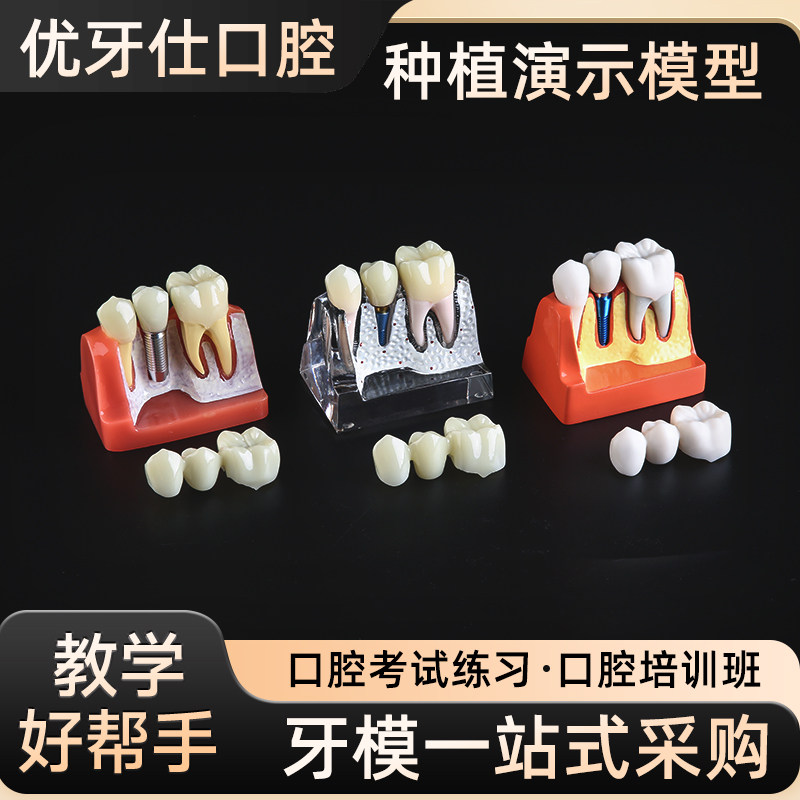 磨牙龋坏解剖前病理教学模具图片