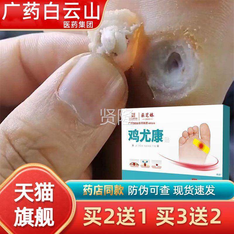 广药白云鸡眼贴灵鸡眼膏瘊子山足脚部去底脚TAU趾手部跖疣老茧根
