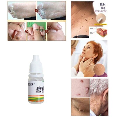 极速2pc Wart Skinl Care Effective Kill Skin Mole Skin Tag Re