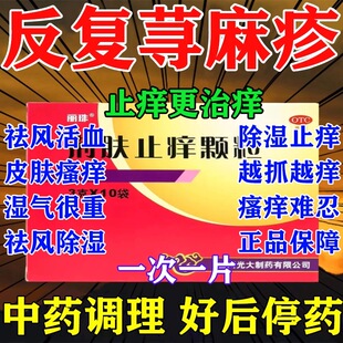 荆肤止痒颗粒官方旗舰店正品治疗瘙痒荨麻疹脓疱疮水疱中成药抗菌