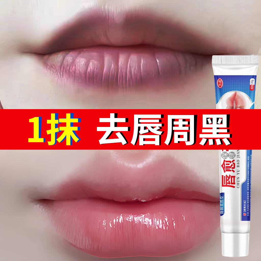改善唇周黑嘴角暗沉淡化唇纹