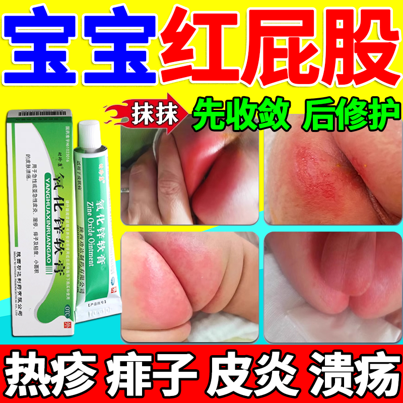 医用护臀膏氧化锌软膏新生婴儿防红屁股屁屁专用宝宝尿布湿疹药膏