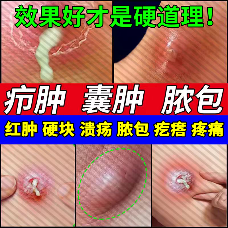 【双龙】蒲地蓝消炎片0.31g*48片/盒