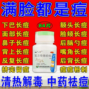 复方珍珠暗疮片祛痘清热解毒片内调祛痘痤疮丸祛痘药内服药口服药