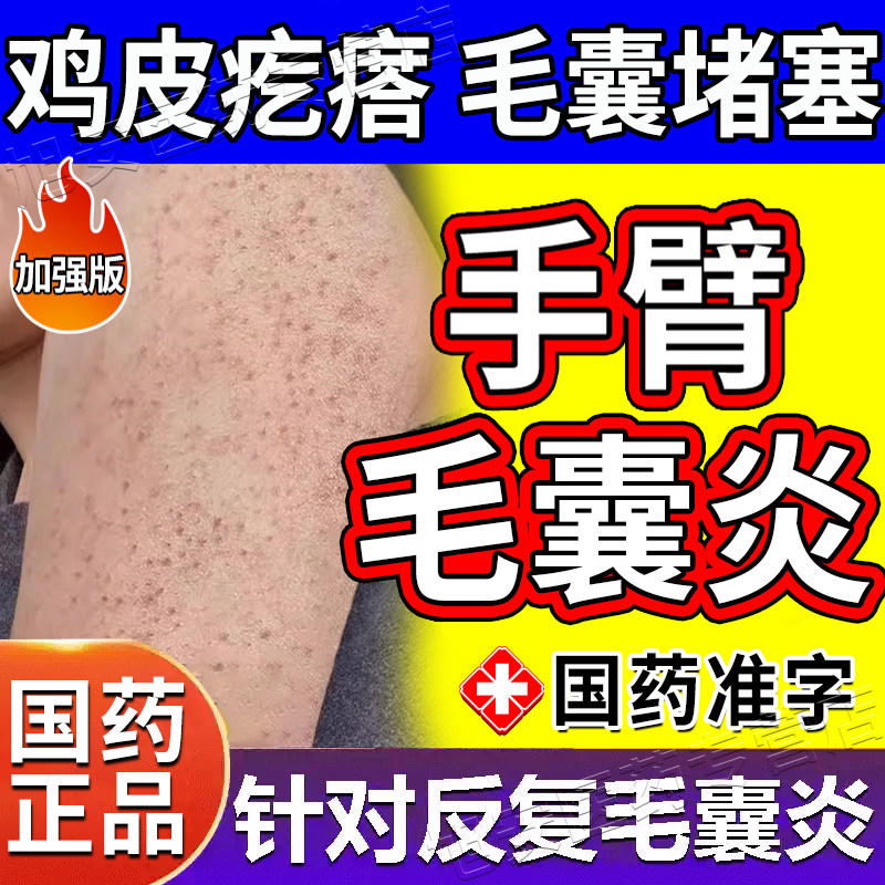 治疗手臂毛囊炎专用药胳膊上长疙瘩鸡皮肤疙瘩毛囊角化症专用药膏