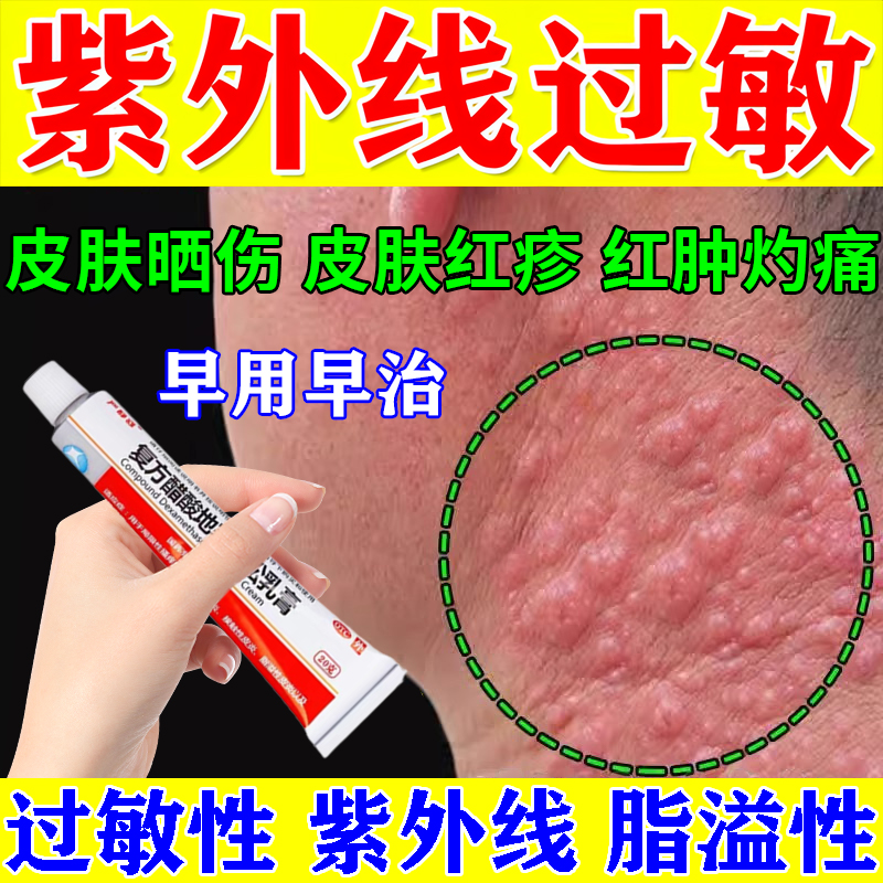 【严静舒】复方醋酸地塞米松乳膏20g*1支/盒
