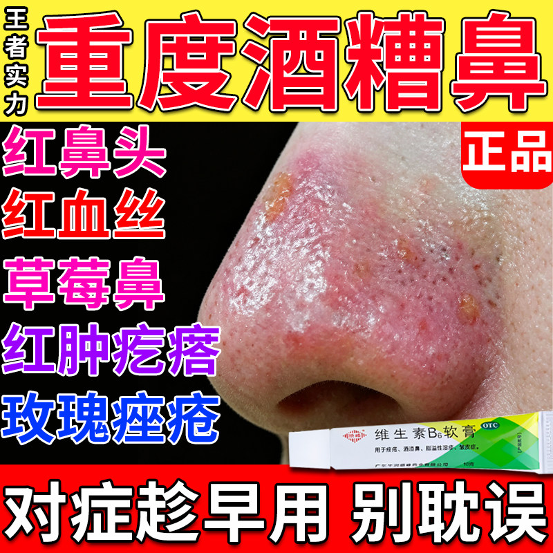 [双燕牌]维生素B6软膏1.20%*10g*1支/盒