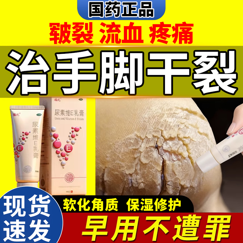 尿素维生素e乳膏正品医用外用手脚后跟干裂开裂手足皲裂修复软膏