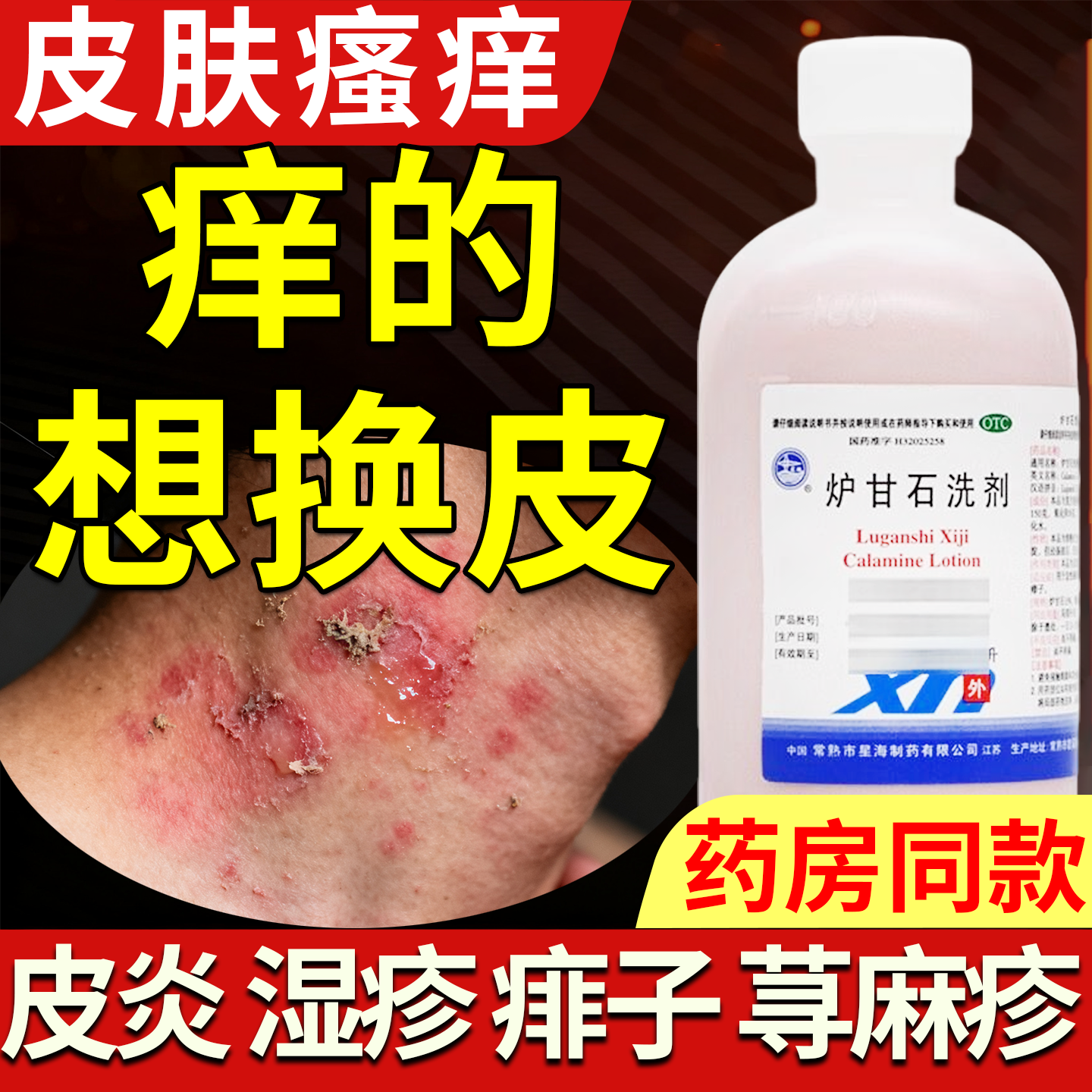 炉甘石洗剂外用湿疹止痒去皮肤瘙痒根止痒外用的特顽固皮炎效药膏