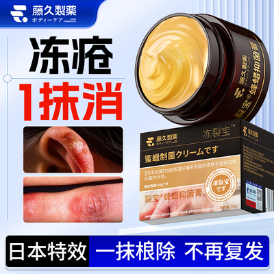日本手脚冻疮膏止痒冻伤膏