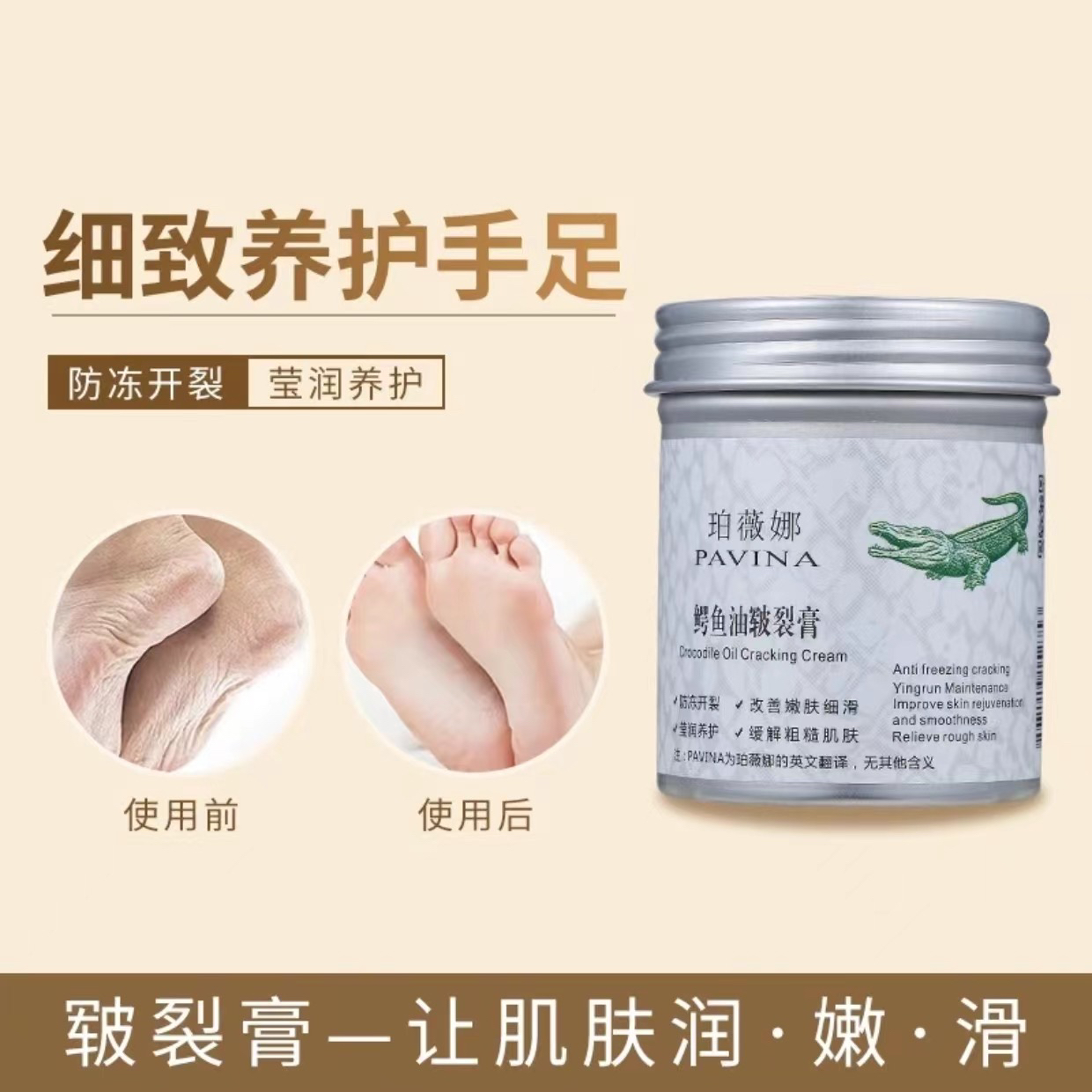 珀薇娜鳄鱼油皲裂膏护手霜滋润保湿裂口干裂起皮秋冬干燥手足养护