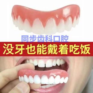 咀嚼定型仿真硅胶假牙道具牙套门牙临时牙齿 没牙用
