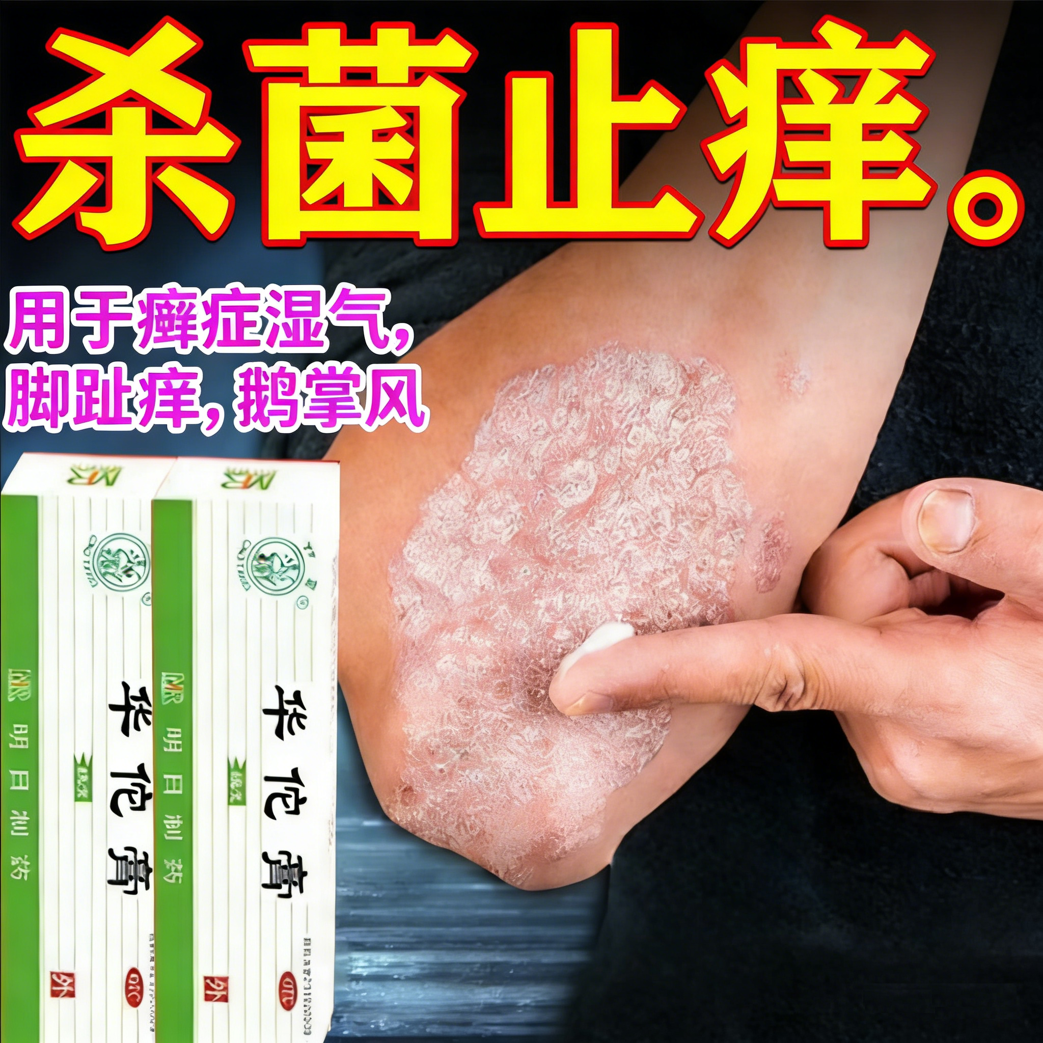 华佗膏正品官方旗舰店治疗鹅掌风脱皮干裂真菌感染杀菌止痒专用药