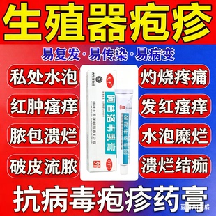 阿昔洛韦凝胶软膏乳膏正品生殖器疱疹专用药私处瘙痒水泡病毒感染
