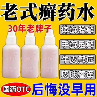 老式癣药水复方土槿皮酊皮肤癣药水止痒皮肤瘙痒止痒抑菌全身外用