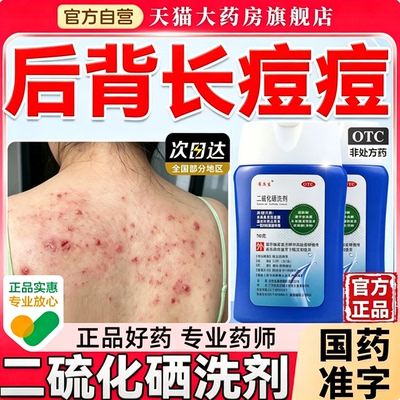 二硫化硒洗剂希尔生后背长痘痘毛囊炎前胸发痒发红疙瘩医用级正品
