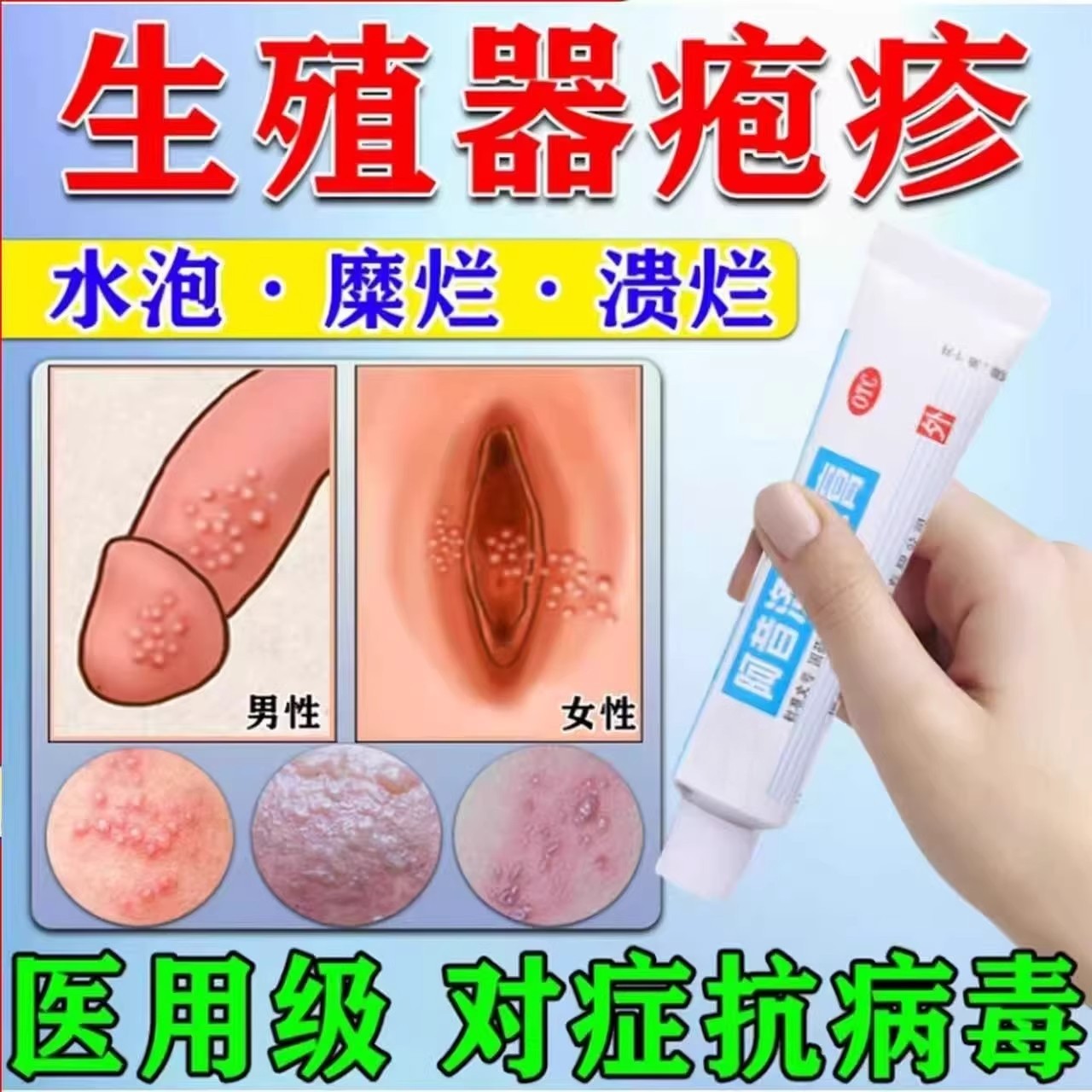 阿昔洛韦软膏乳膏凝胶正品官方旗舰店进口蛇缠腰私处疱疹特i效药,OTC药品/国际医药,抗病毒类,淘宝优惠券,粉丝福利购,淘宝优惠卷