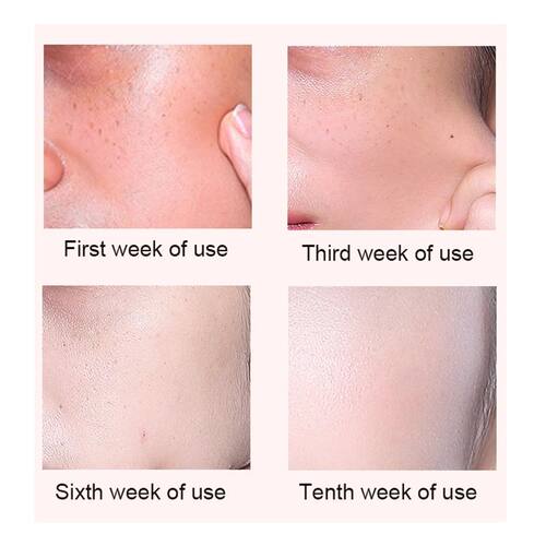 极速100ml Blood Orange Serum SkAin Whitening Face Serum Vita