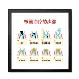 牙科挂图口腔解j剖知识装饰画照片墙医院沙发种植海报健康结构-15