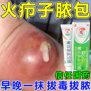 火疖子药膏脸部头皮私处毛囊炎疖肿感染痘痘脓疱抑菌莫匹罗星软膏