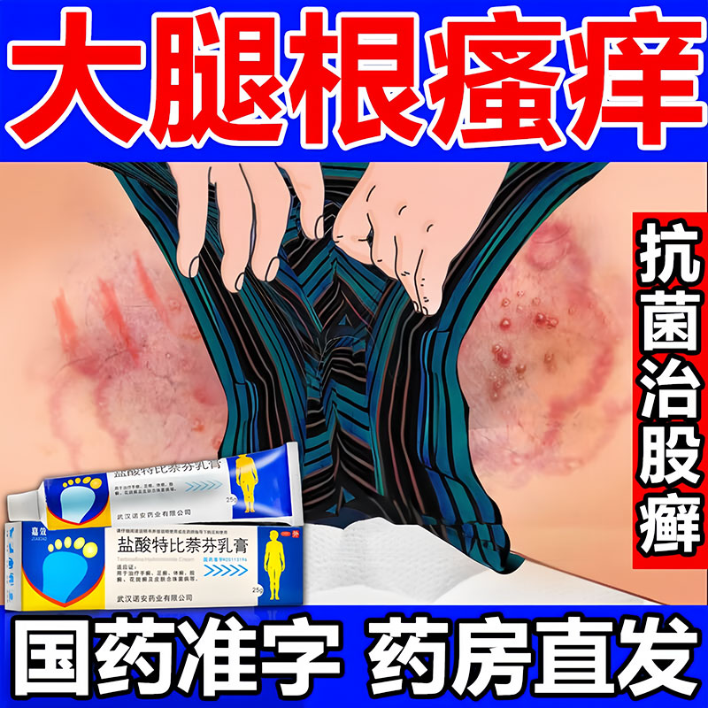 股藓大腿内侧真菌感染股癣去专用药膏皮肤瘙痒止痒湿疹股廯瘙痒