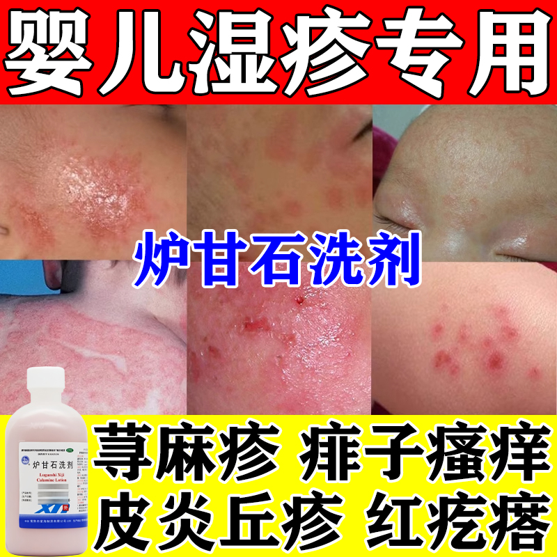 【星海】炉甘石洗剂100ml*1瓶/盒
