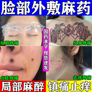 麻药外敷脸部医用麻药点痣专用点疣纹身纹绣小麻膏麻醉药利多卡因