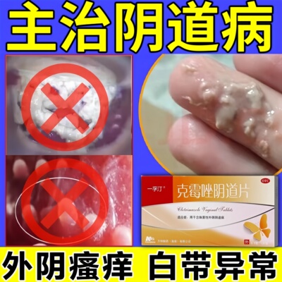 霉菌性妇科阴道炎用外阴瘙痒专用菌药栓塞克霉唑栓阴道片一片装
