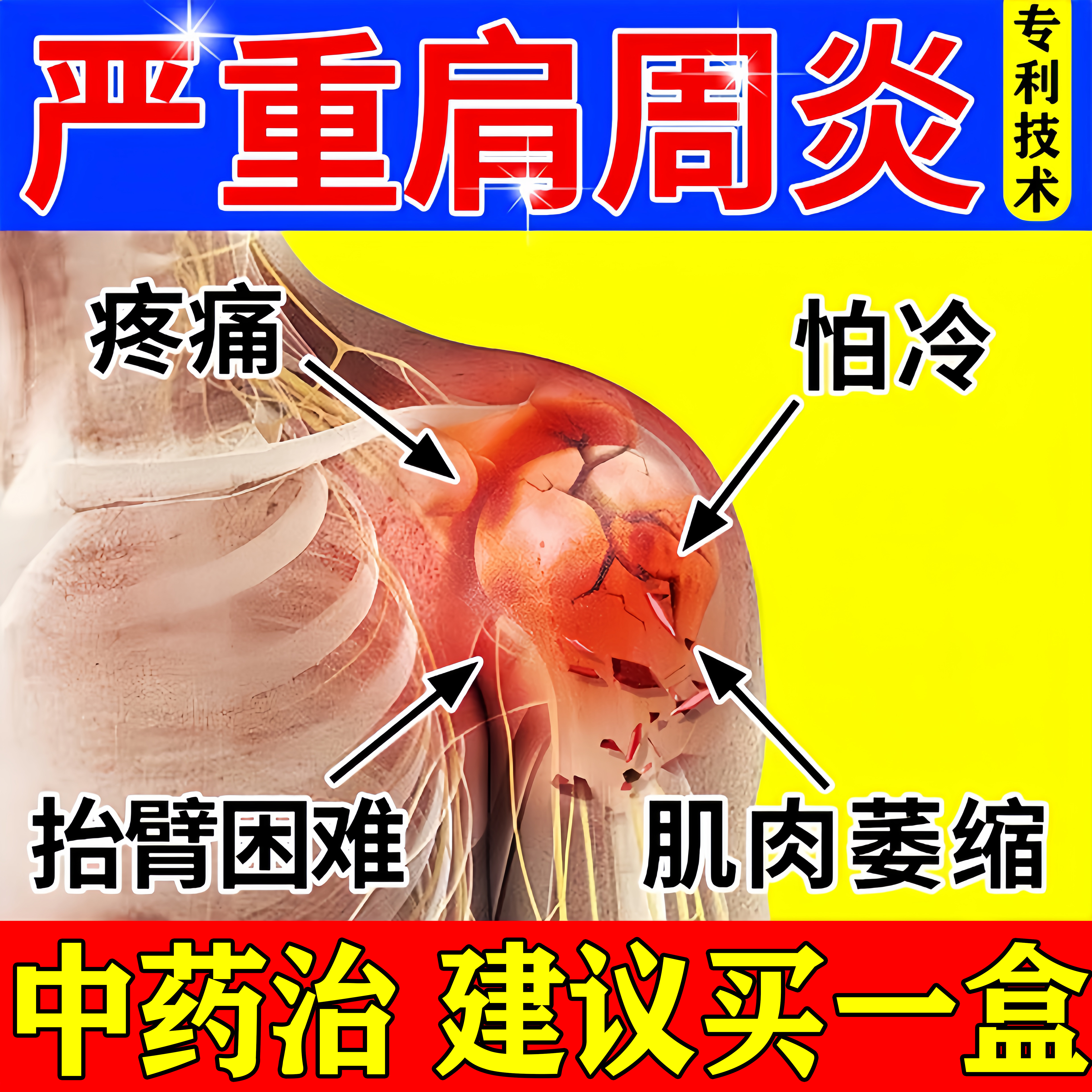 壮骨麝香止痛膏10贴舒筋活血化瘀疏通经络肩膀疼痛专用肩周炎贴膏