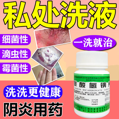 碳酸氢钠片冲洗妇科治疗霉菌性阴道炎阴道瘙痒白带异常增多有异味