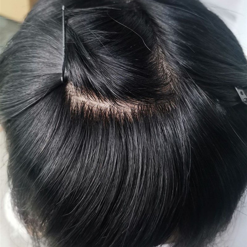 假发男全递针生物皮真发头顶补发片自然逼真全递针秃顶地中海假发