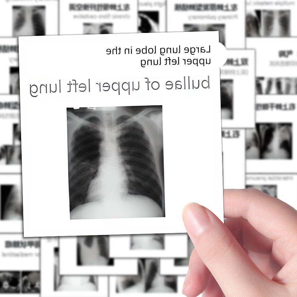 96张医学影像图解贴纸医学生笔记放射科影像诊断学学习贴画自粘贴