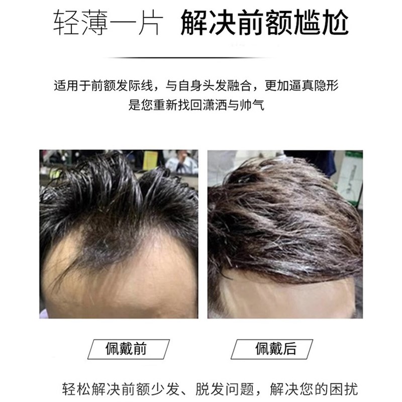 发际线假发贴男士假发片隐形无痕贴片真发M型前额补发片刘海片男