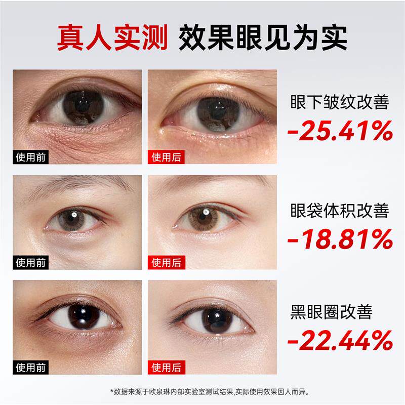 眼部按摩仪美眼仪消肿黑眼圈眼袋按摩提拉紧致缓解疲劳眼部美容仪