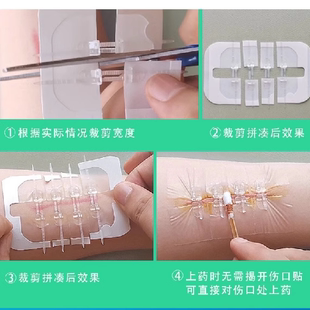 妥能弹性绑带医用皮肤减张器伤口愈合免缝合剖腹产创口疤痕减张贴