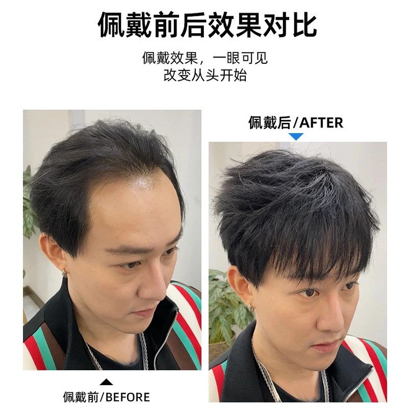 发际线假发贴男士前额全真v发m型假刘海轻薄自然遮盖无痕补发贴片
