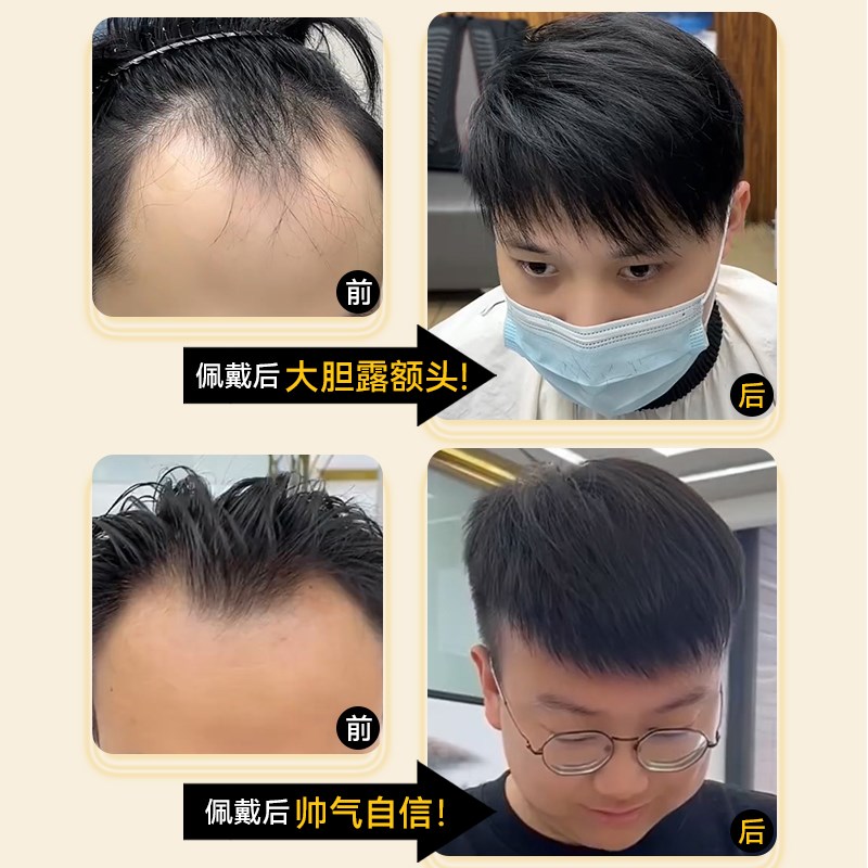 深V发际线 线假发贴男前额无痕补发片全真人发M型蓬松隐形浏海假