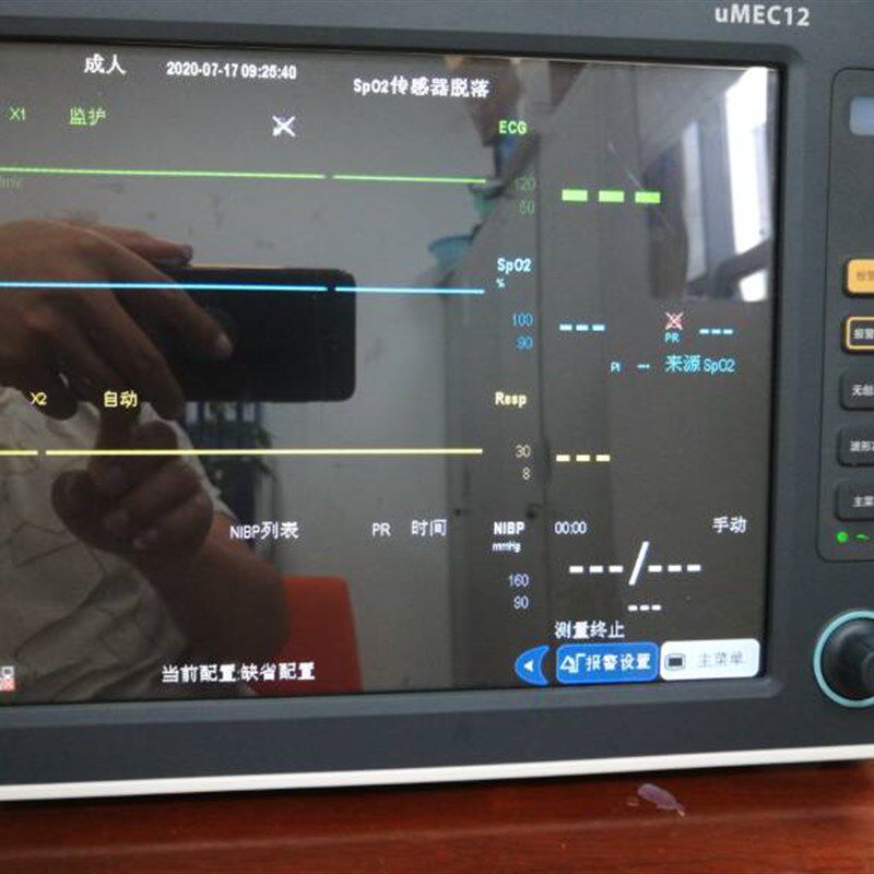 迈瑞心电监护仪uMEC12液晶屏幕 医疗显示屏UMEC12