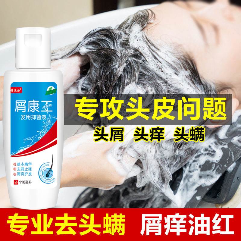 屑康王去屑止痒洗发水露去头屑毛囊抑菌除螨洗护旗舰店诗莱格正品