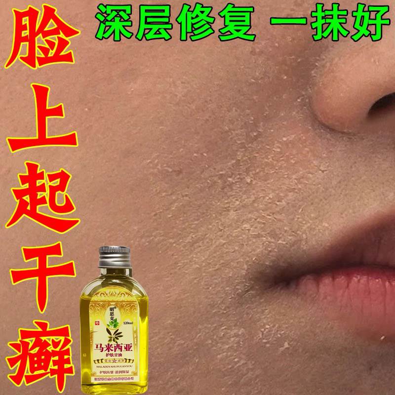 脸干燥粗糙嘴起皮脱皮掉皮有碎屑鼻子下巴起干癣止痒修护擦脸甘油