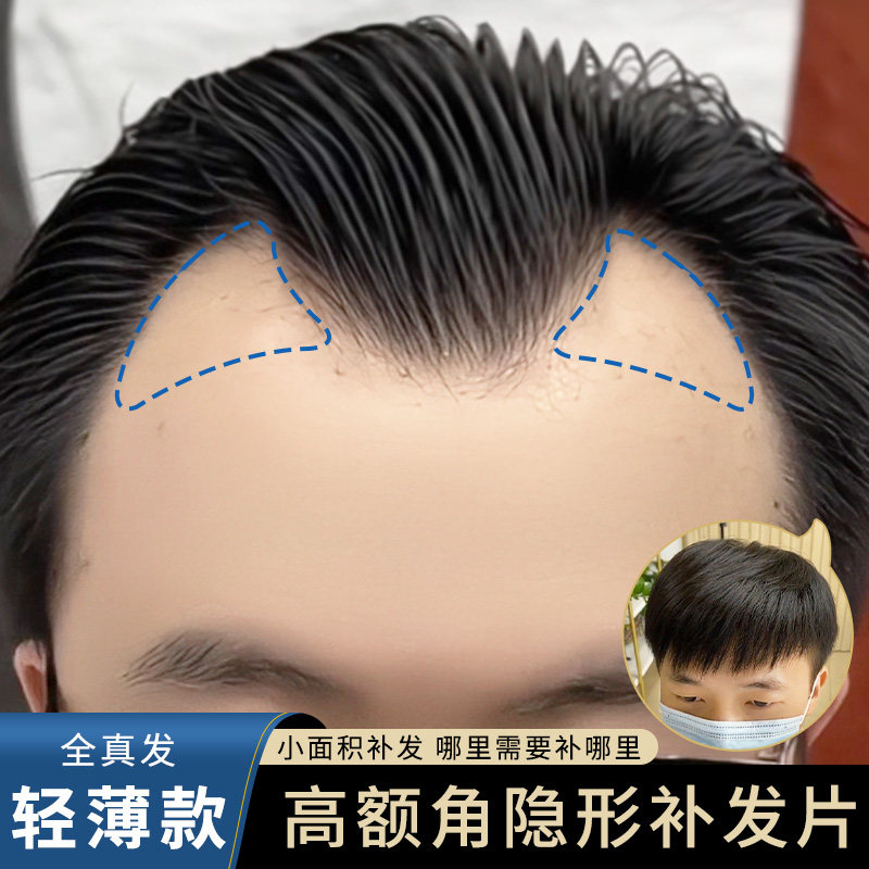 额角发际线贴男m型发际线假发贴鬓角真发片前额补发隐形假发片男