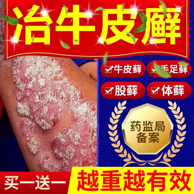 【进口技术】无激素不满可退