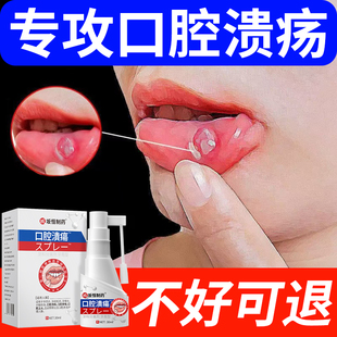 日本口腔溃疡灵黏膜修复液喷剂凝胶药膏舌头消炎护理喷雾专用