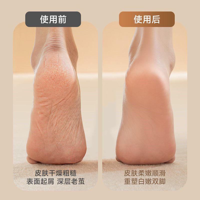 电动磨脚器充电插电式自动磨脚B皮去脚皮死皮老茧磨脚神器修足机