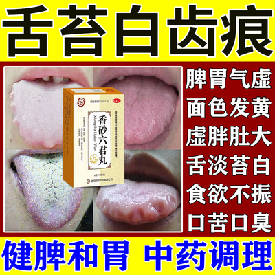香砂六君丸正品舌头裂纹有齿痕健脾祛湿调理脾胃虚弱湿气重中成药