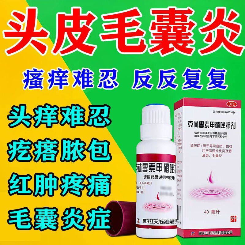 治疗头上长痘痘头皮毛囊炎头部脂溢性皮炎头痒克林霉素甲硝唑搽剂